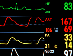 Blood pressure and heart rate are two health indicators